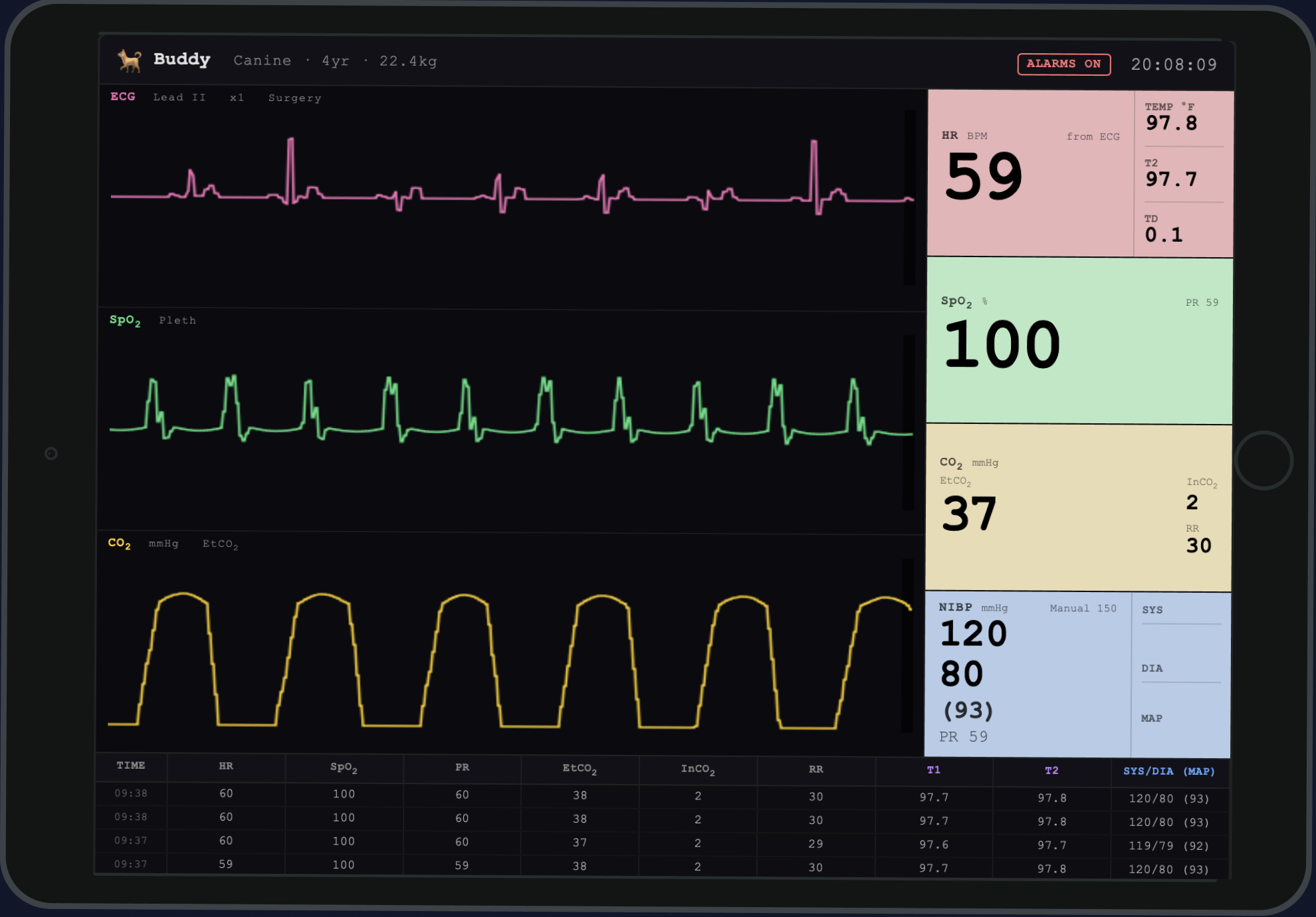 Patient monitor displaying live simulated vitals